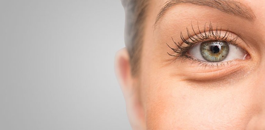 Post-Operative Care Tips for Eyelid Surgery Patients in Dubai