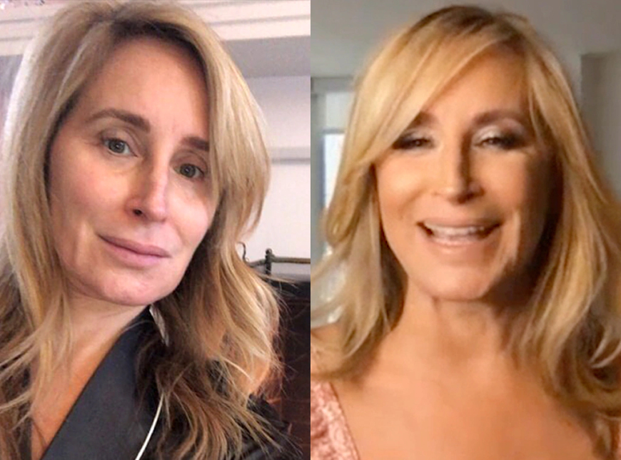 Celebrity Mid Facelift Transformations A Closer Look