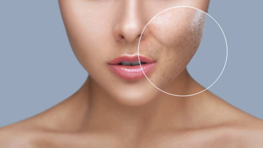 Say Hello to Clear Skin: Laser Scar Treatment in Abu Dhabi