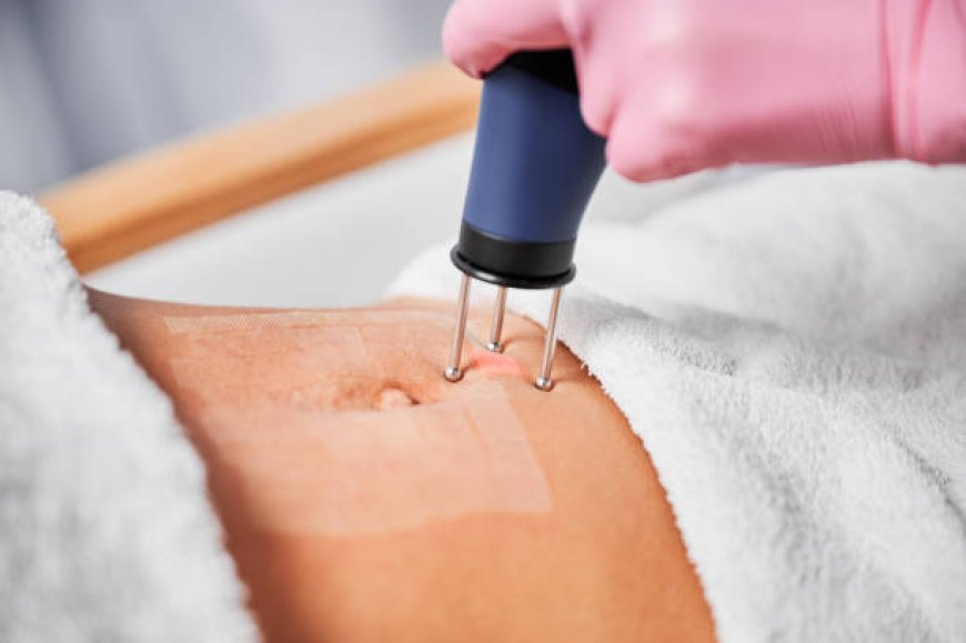 Achieve Radiant Skin with Laser Skin Tightening in Abu Dhabi