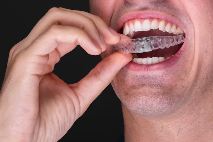 Invisalign - Invisible Orthodontics Technique That Permits the Correction of Your Teeth