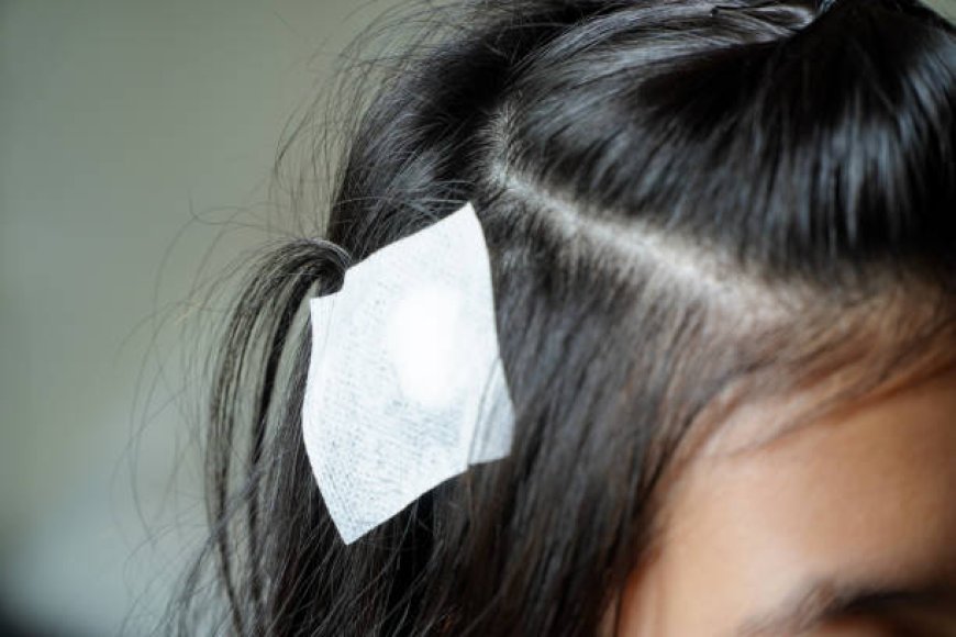 Front Hairline Hair Patch: Abu Dhabi Cost Considerations