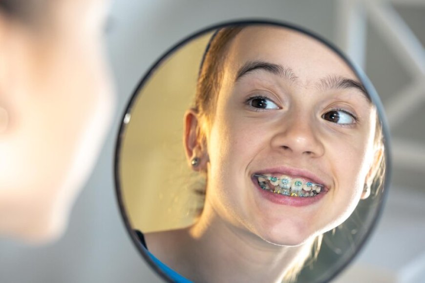 Orthodontic Correction in Rayne, LA: Correcting Misaligned Teeth