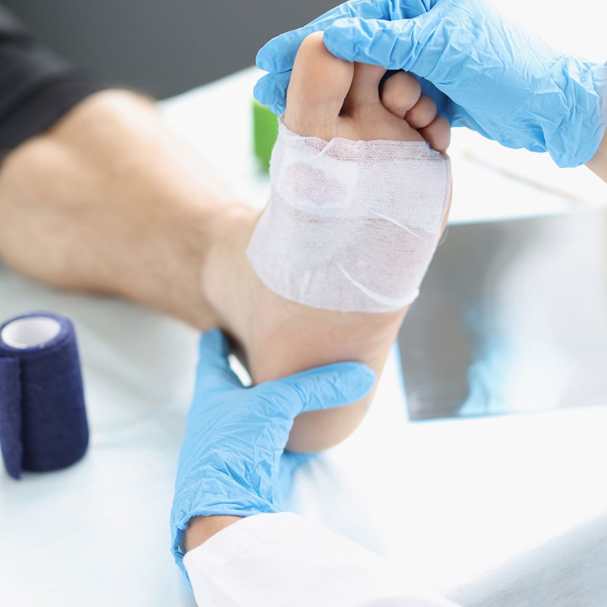 Advanced Medical Dressings Market Set to Witness Explosive Growth by 2033