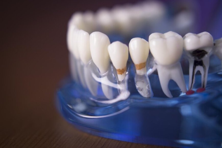 Achieve Your Perfect Smile with Dental Crowns in Jackson, TN