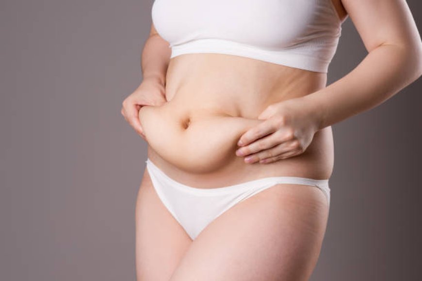 FAQs About Tummy Tuck Surgery in Abu Dhabi