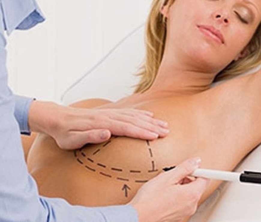 How Is Boob Job Surgery Performed Breast Augmentation