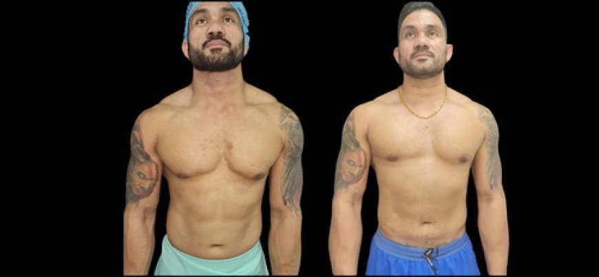 Dubai's Commitment to Wellness: Male Breast Reduction Options