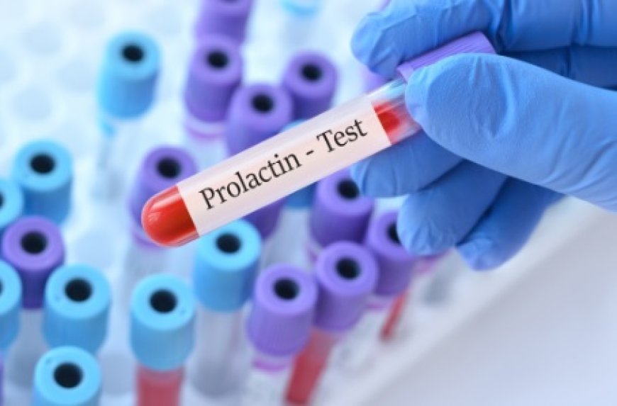 A Step-by-Step Guide to Treating High Prolactin with Cabgolin