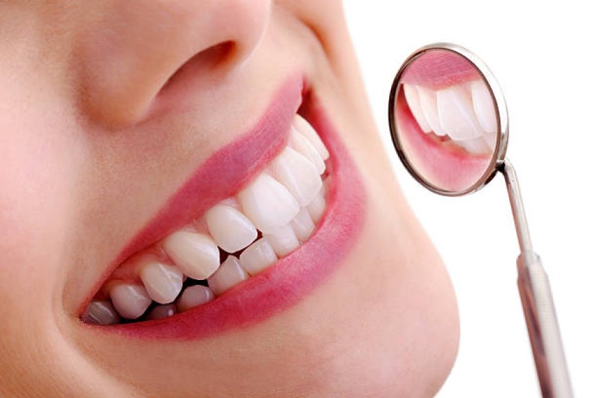 A Brighter Smile Awaits: Teeth Whitening in Riyadh