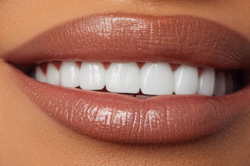 Transform Your Look: Riyadh's Premiere Teeth Whitening Solutions