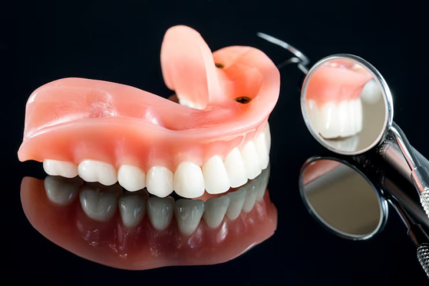 Understanding Implant Supported Dentures: Cost, Function, Appearance and Maintenance