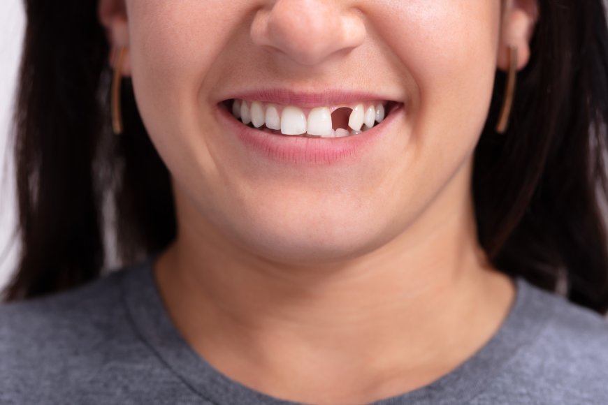 Smile Bright: Dealing with Missing Teeth