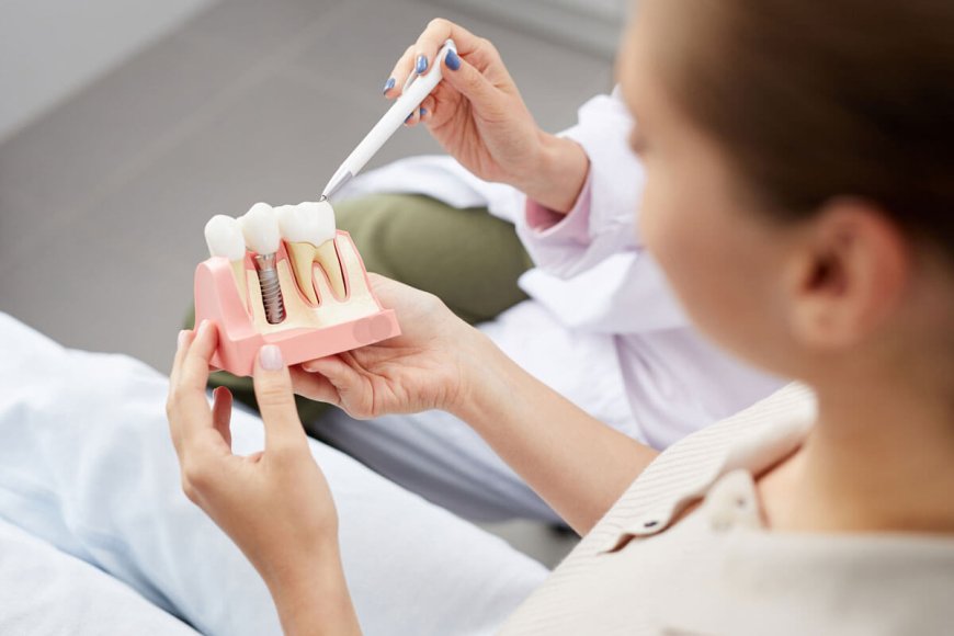 How Much Does a Dental Implant Cost? Here’s What You Need to Know