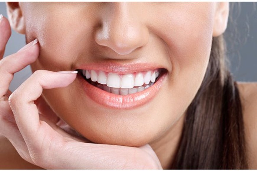 Transform Your Smile: The Simple Beauty of Veneers