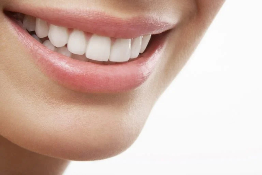 Straighten Up: Simple Solutions for Perfect Teeth