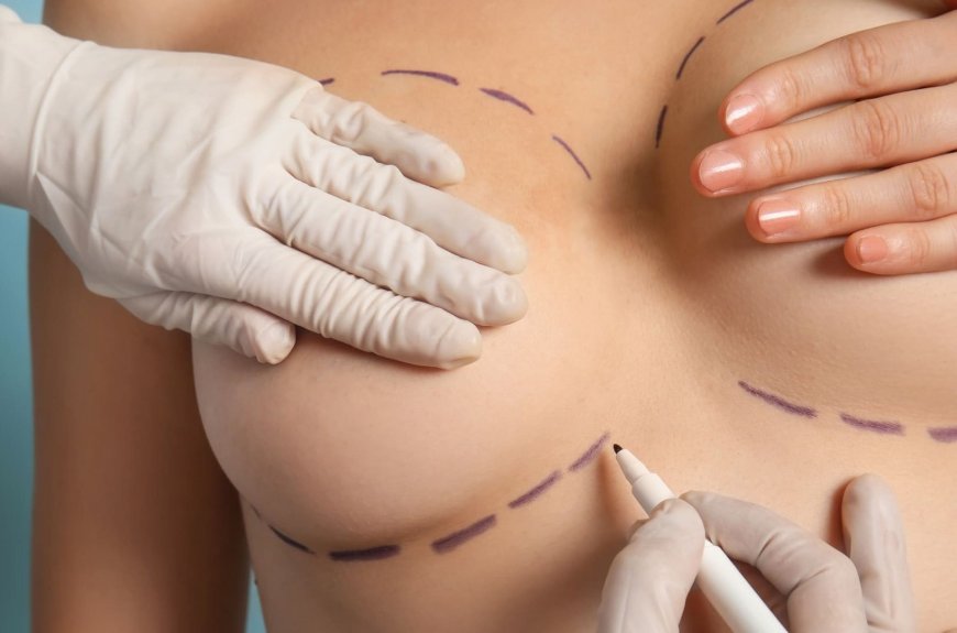 Recovery After Breast Fat Transfer in Dubai What to Expect