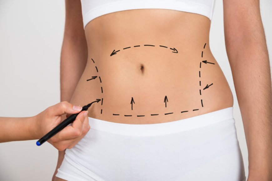 Tumescent Liposuction: Conditions and Treatments