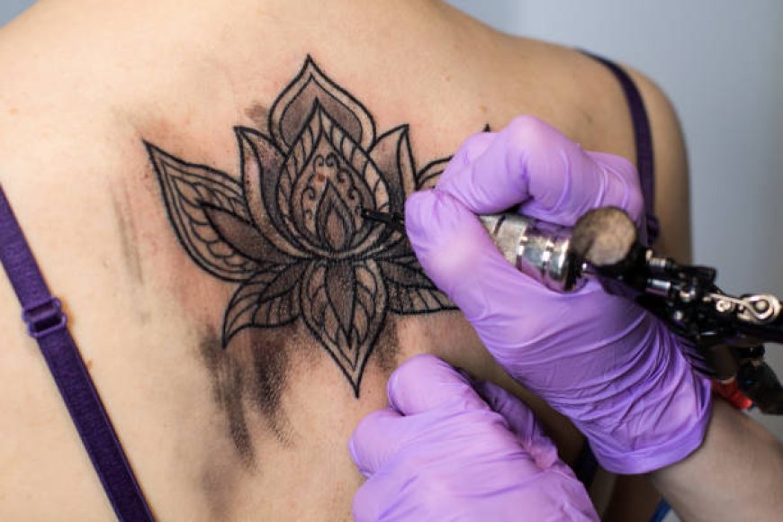 Renew Your Appearance: Tattoo Removal Clinics in Riyadh
