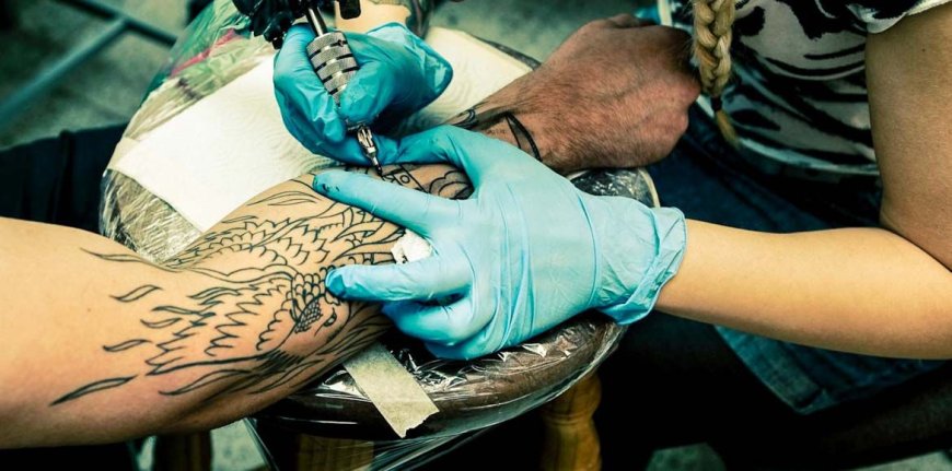 Can Tattoos Be Removed Completely by Experts?