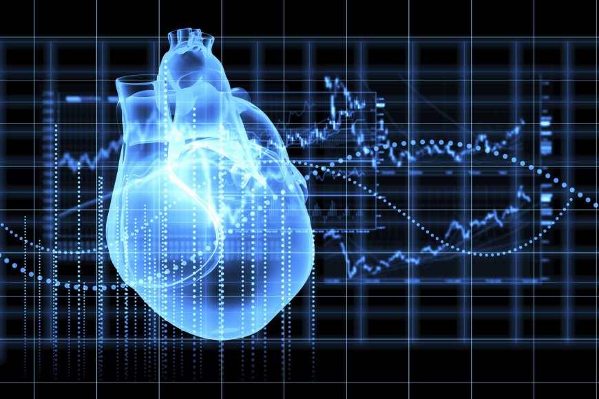 Cardiovascular Information System Market Analysis, Recent Trends and Regional Growth Forecast to  2024-2032