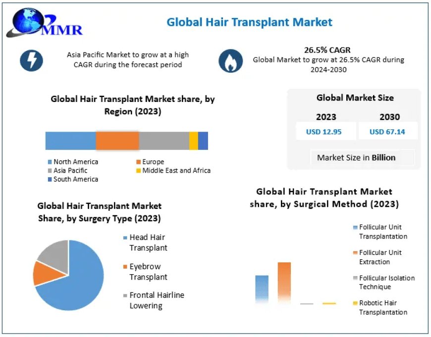Hair Transplant Market Size Chronicles Unveiled: Market Dynamics, Growth, and Trends | 2023-2030