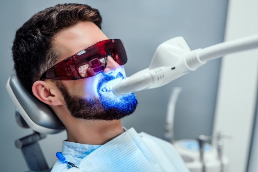 The Importance of Professional Teeth Whitening