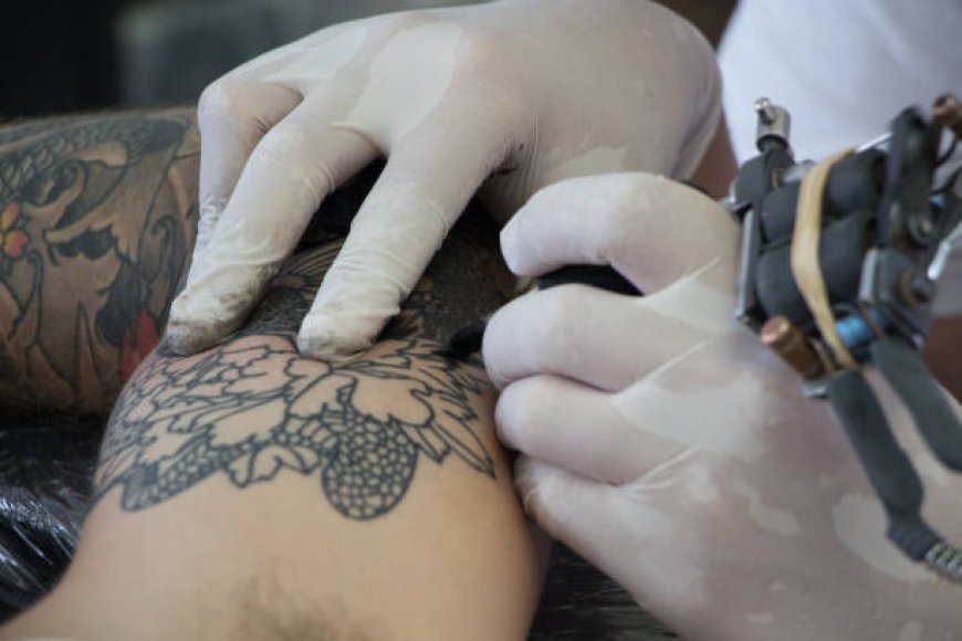 Clear Your Canvas: Tattoo Removal Clinics in Riyadh