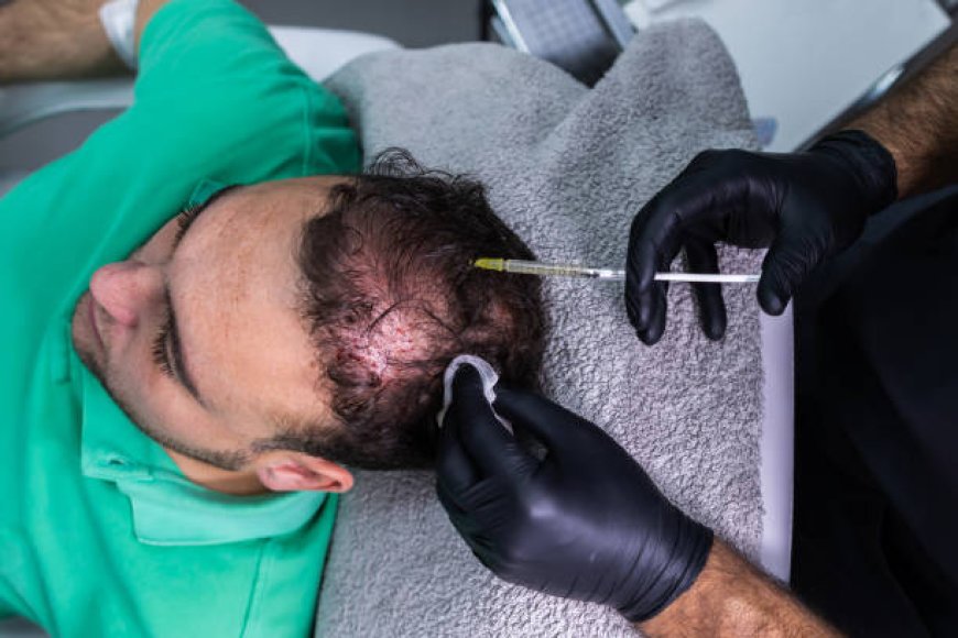 PRP Hair Treatment Cost in Abu Dhabi: A Complete Guide