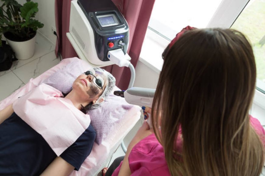 Ultimate Skin Renewal: Laser Carbon Peel in Abu Dhabi