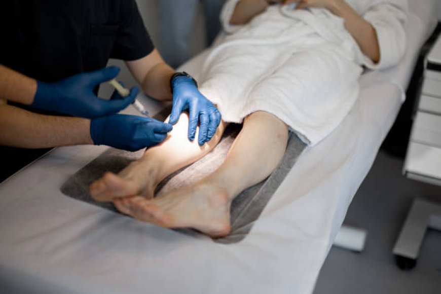 Understanding Sclerotherapy Cost in Abu Dhabi