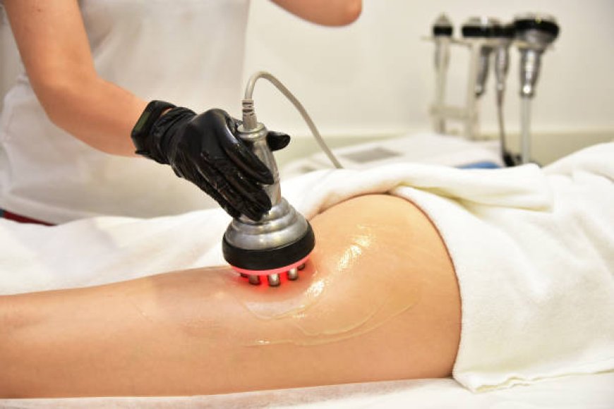 Radiofrequency Treatments in Abu Dhabi: Effective Skin Tightening Solutions