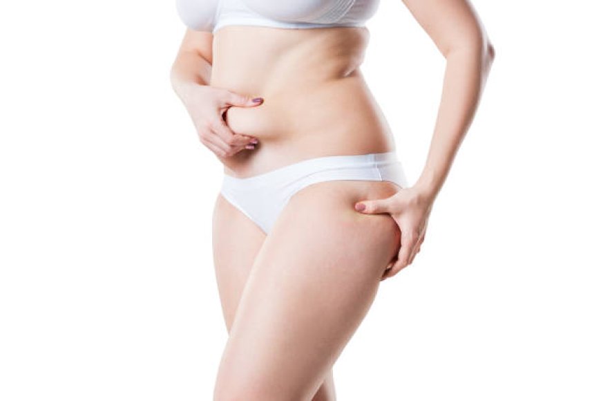 Want a Perfect Body? Liposuction in Abu Dhabi