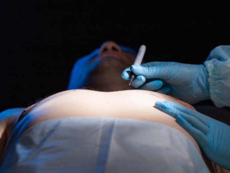 Gynecomastia in Al Ain: Advanced Treatments for Male Chest Contouring