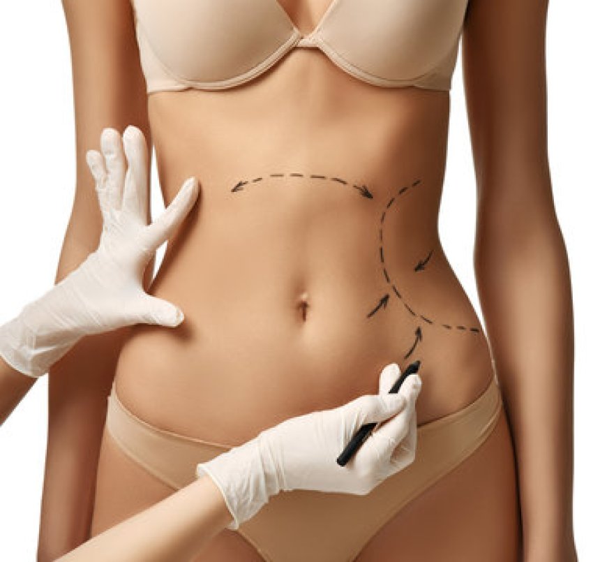 Riyadh Body Liposuction: Costs and Considerations