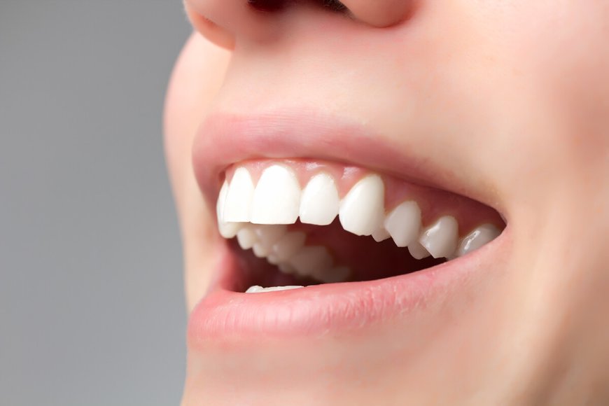 Tips for Healthy Teeth and Gums