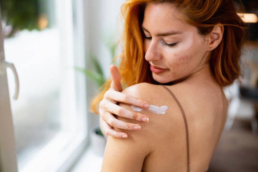 Acne Treatment in Abu Dhabi: Restore Your Skin's Glow
