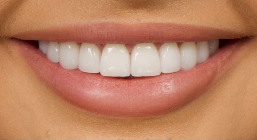 Benefits of Dental Implants vs Traditional Dentures