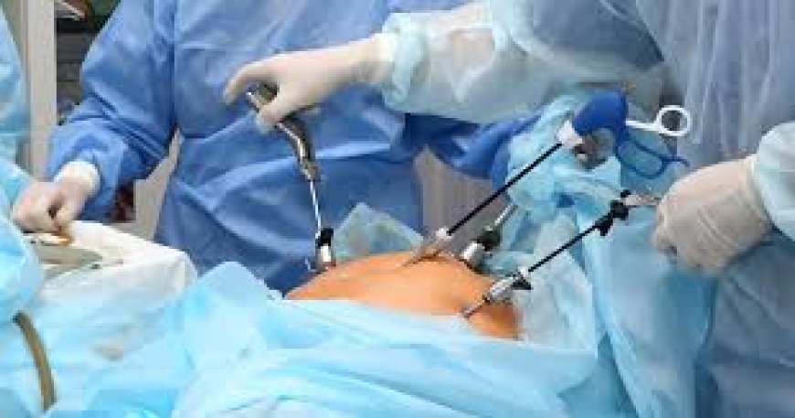 Laparoscopic Surgery: What You Should Know Before Your Procedure