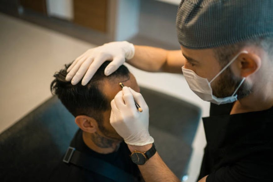 Understanding Hair Transplant Cost in Abu Dhabi: Key Factors