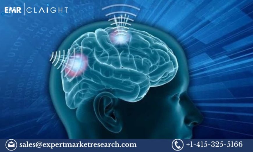 Wireless Brain Sensors Market Analysis and Forecast (2024-2032)