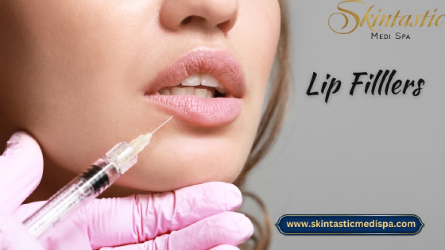 What to Expect from Your First Lip Filler Treatment in Riverside