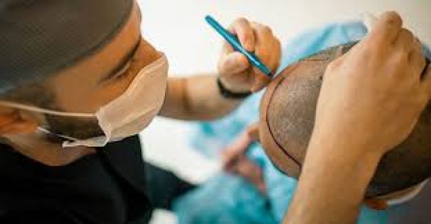 From Bald to Bold: Real-Life Hair Transplant Transformations in Dubai