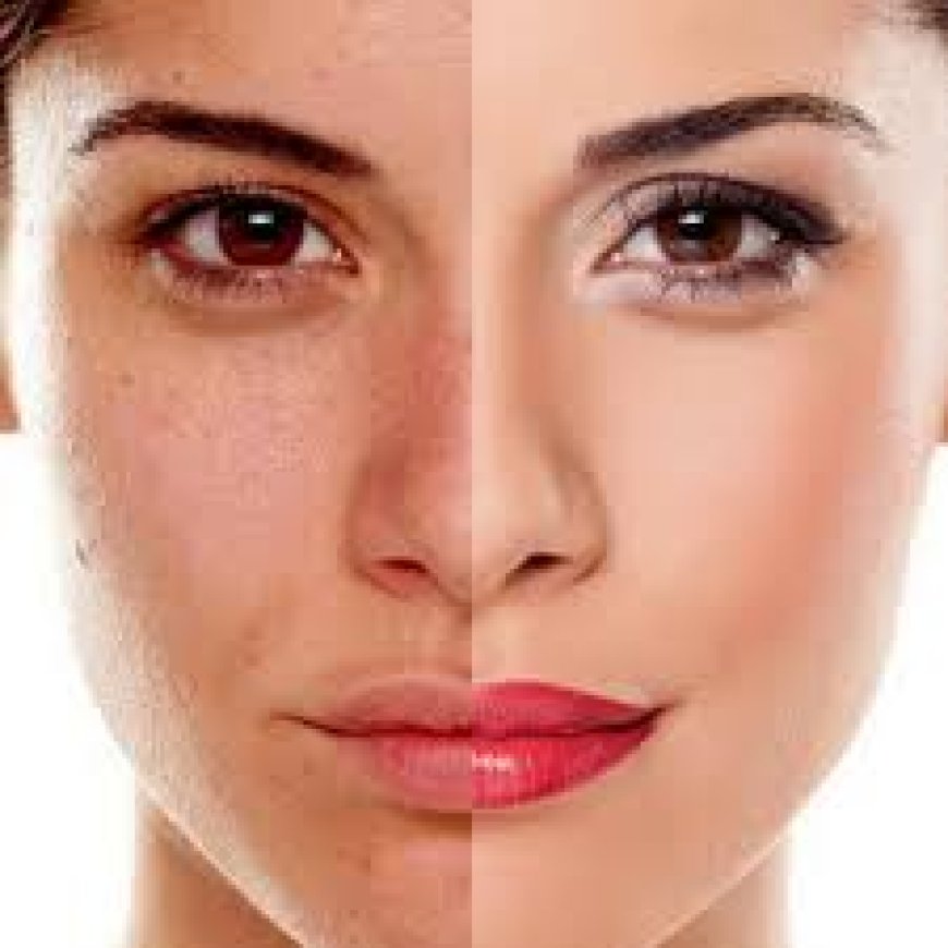 What Are the Specialties of the Best Dermatologist in Dubai