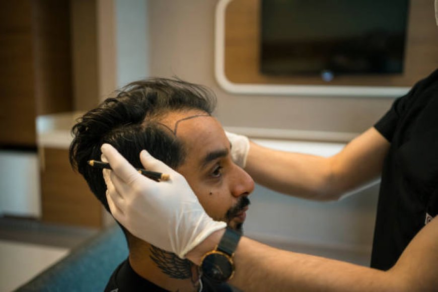 زراعة الشعر بدون ندوب في أبو ظبي: استعد كثافة شعرك بأمان