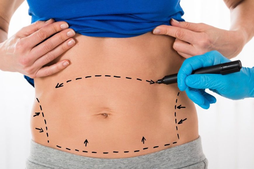 What to Expect from a Tummy Tuck Consultation in Dubai?