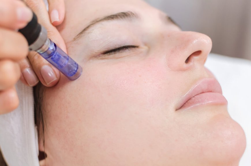 Unlock Your Skin's Potential with Mesotherapy in Dubai