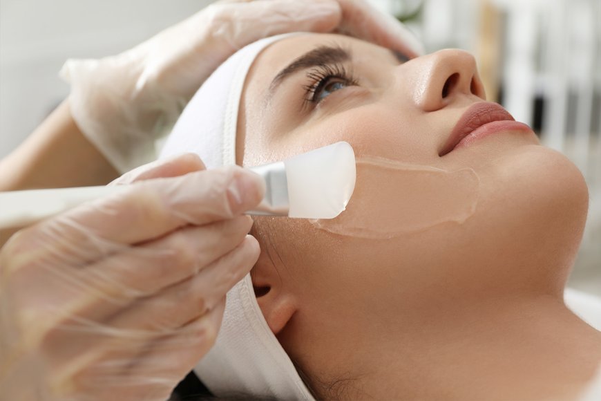 Transform Your Skin with Chemical Peels in Dubai