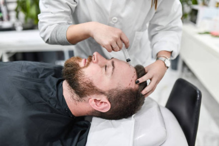 Ultimate Hair Transplant in Dubai: 2024 Edition