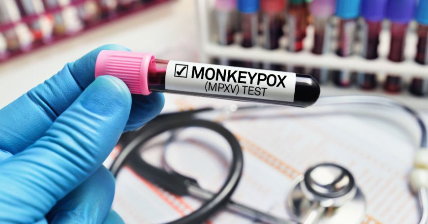 Monkeypox Treatment: Understanding the Disease and Available Therapies